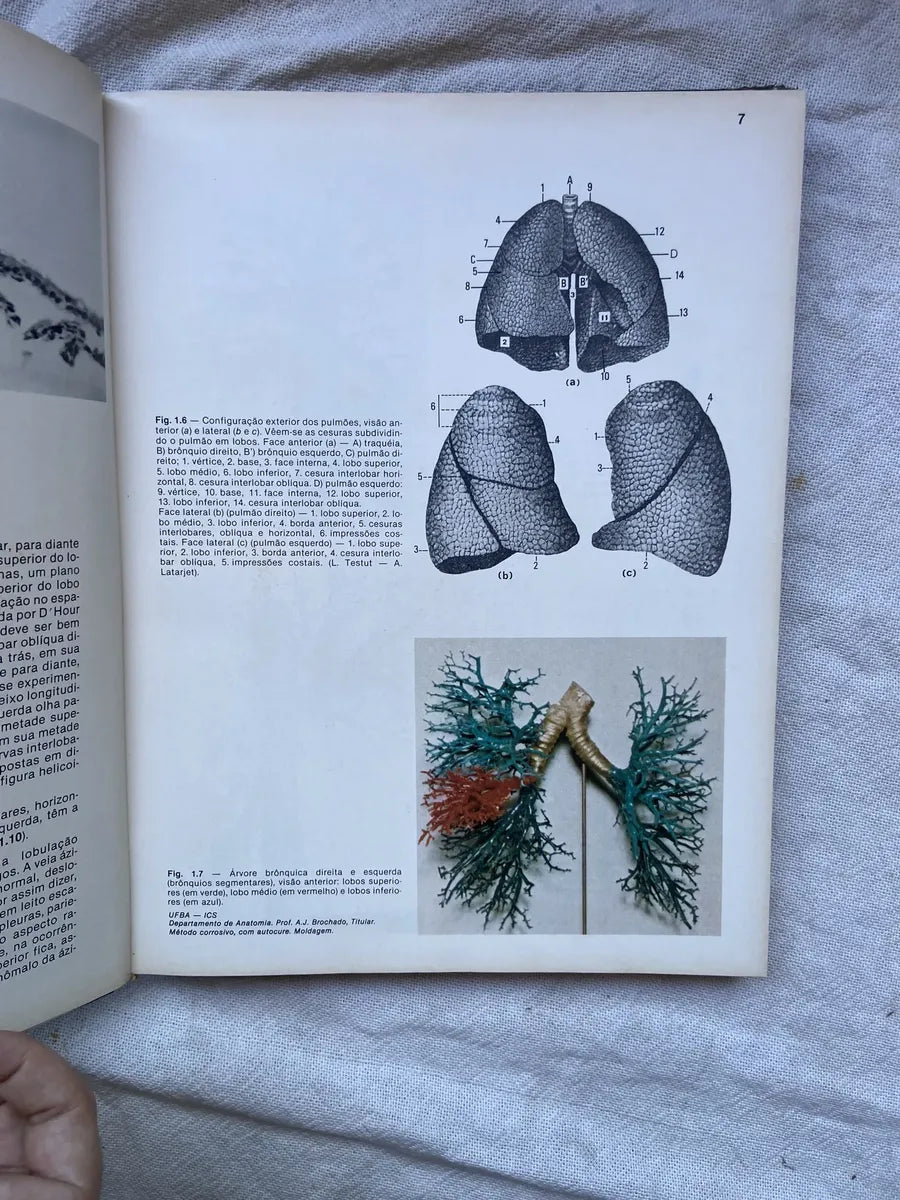 Livro Radiologia Pulmonar 1984 Capa Dura (Usado)