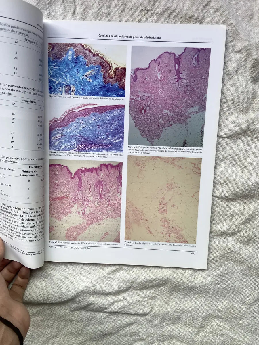 Revista Brasileira De Cirurgia Plástica Volume 34 Número 4 outubro dezembro 2019 (Usado)