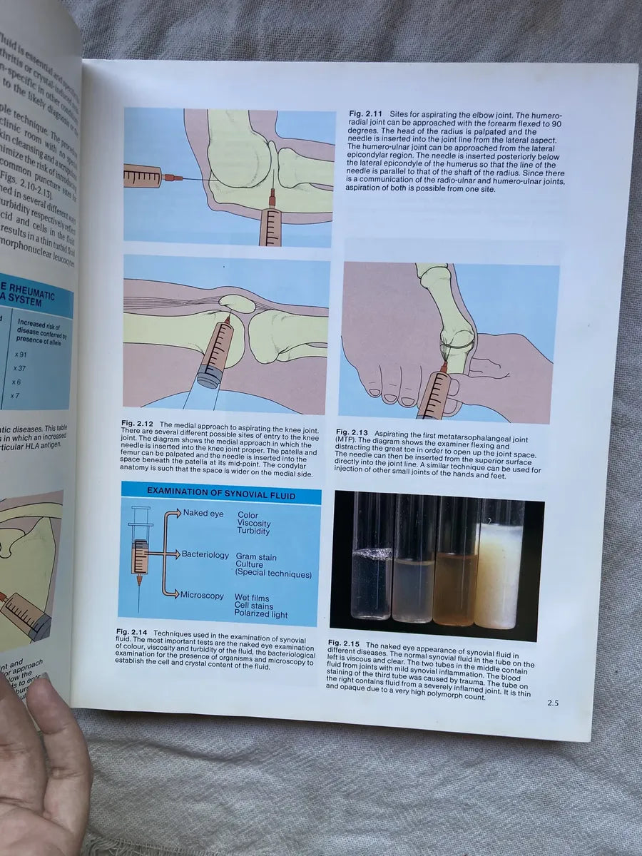 Livro Atlas Of Clinical Rheumatology 1986 (Usado)