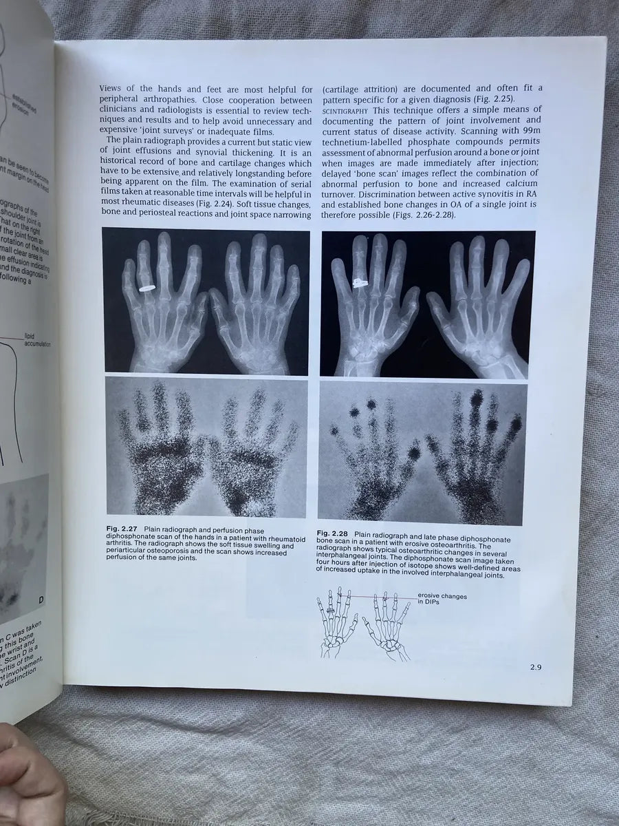 Livro Atlas Of Clinical Rheumatology 1986 (Usado)