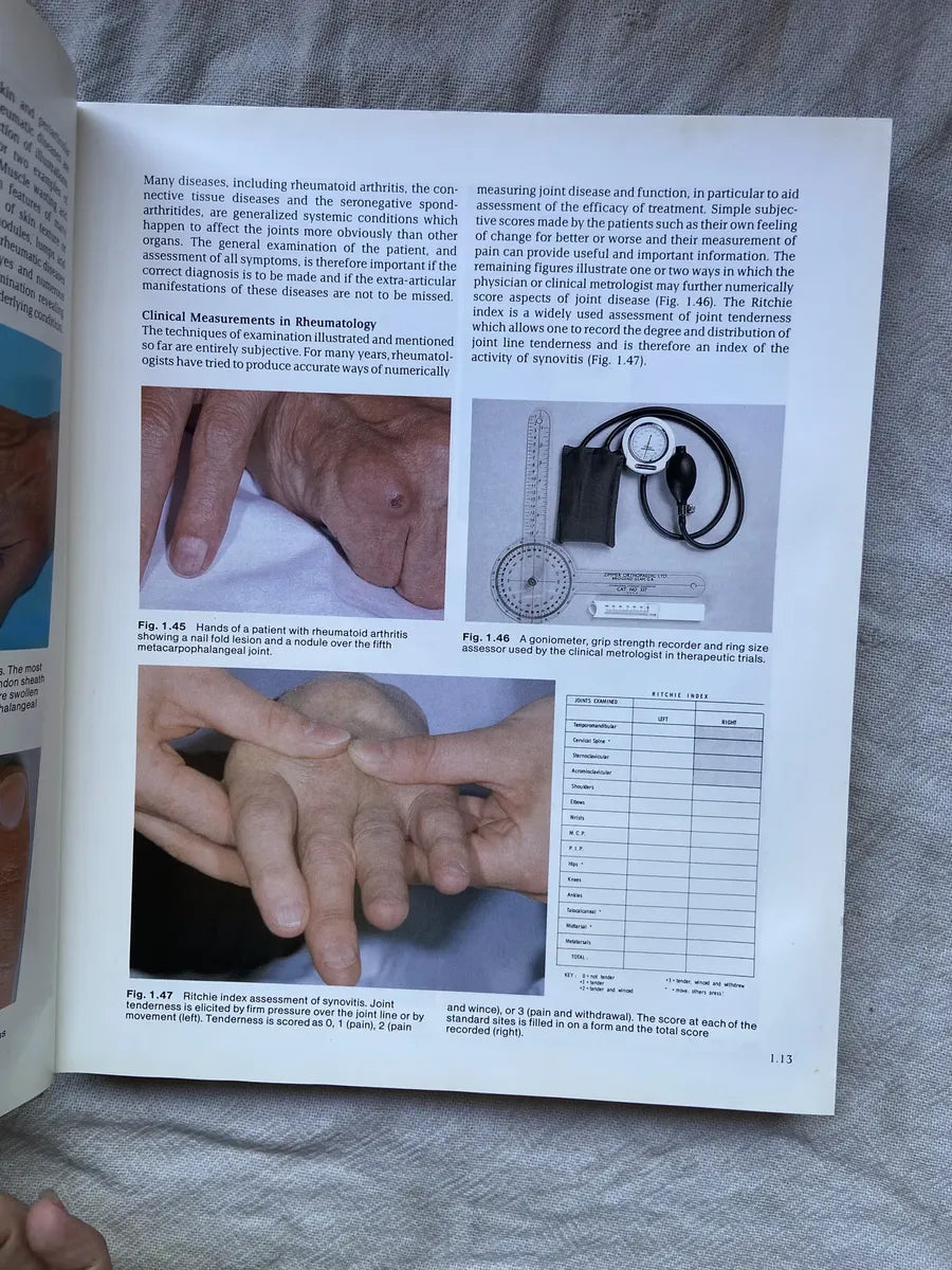 Livro Atlas Of Clinical Rheumatology 1986 (Usado)