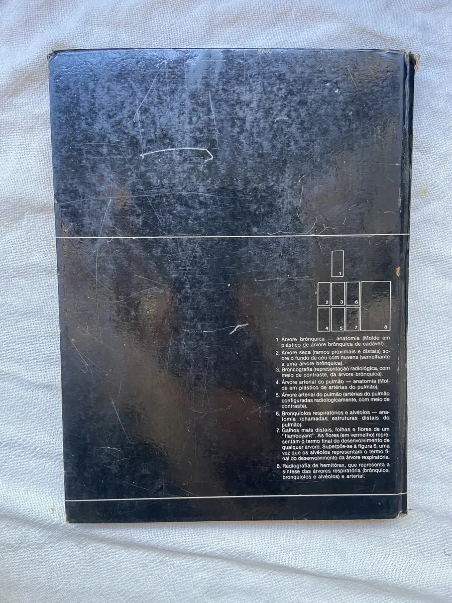 Livro Radiologia Pulmonar 1984 Capa Dura (Usado)