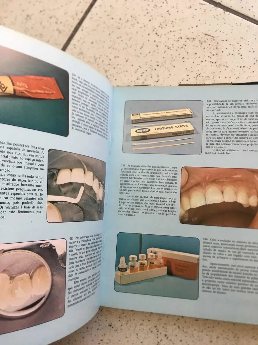 Livro Atlas De Dentística Restauradora Edmir Matson 1982 (Usado)