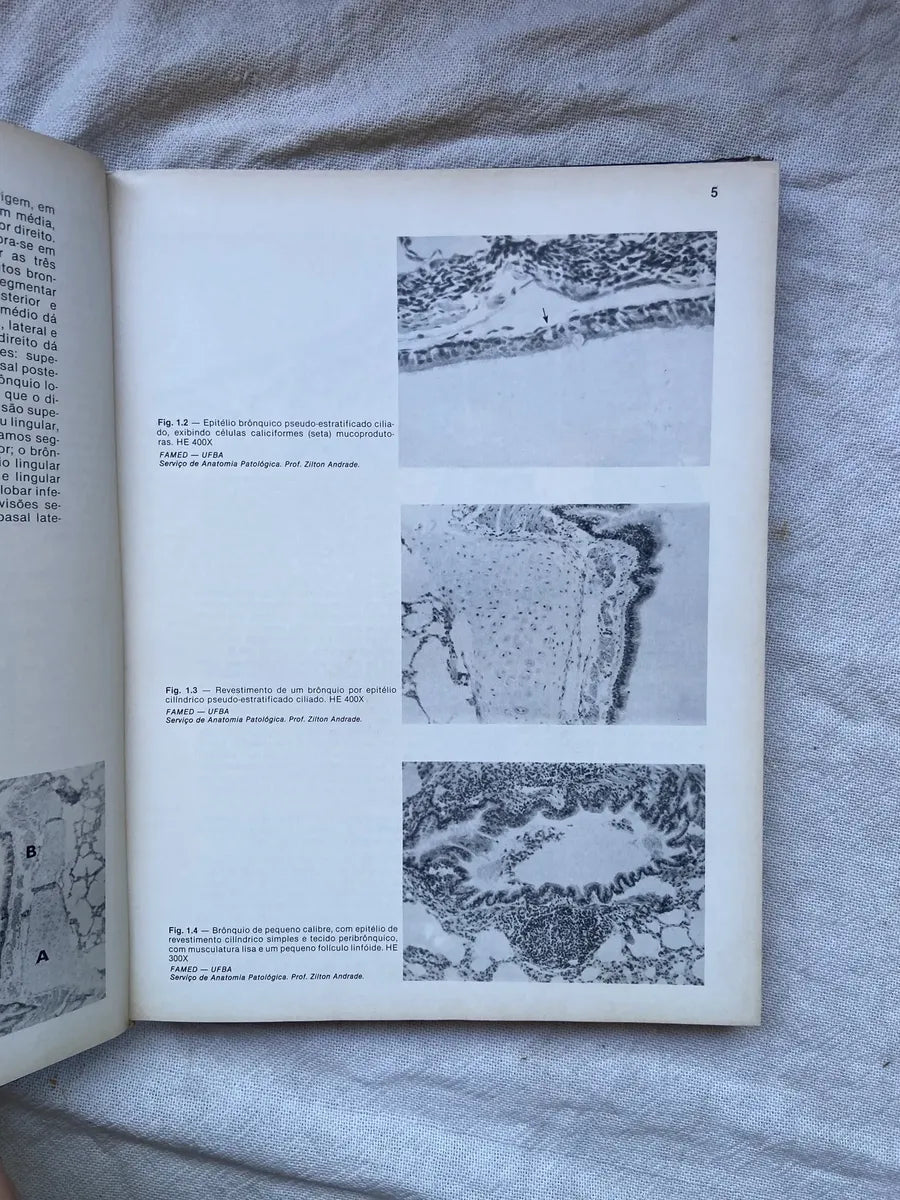 Livro Radiologia Pulmonar 1984 Capa Dura (Usado)