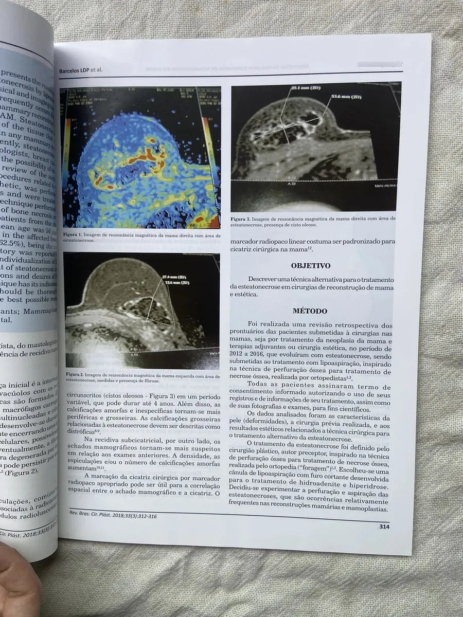 Revista Brasileira De Cirurgia Plástica Volume 33 Número 3 julho setembro 2018 (Usado)