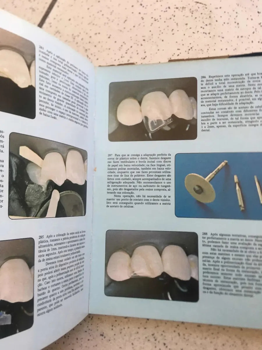Livro Atlas De Dentística Restauradora Edmir Matson 1982 (Usado)