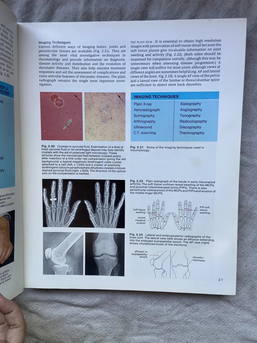 Livro Atlas Of Clinical Rheumatology 1986 (Usado)