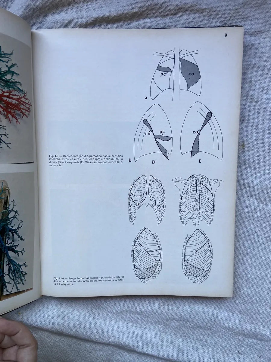 Livro Radiologia Pulmonar 1984 Capa Dura (Usado)
