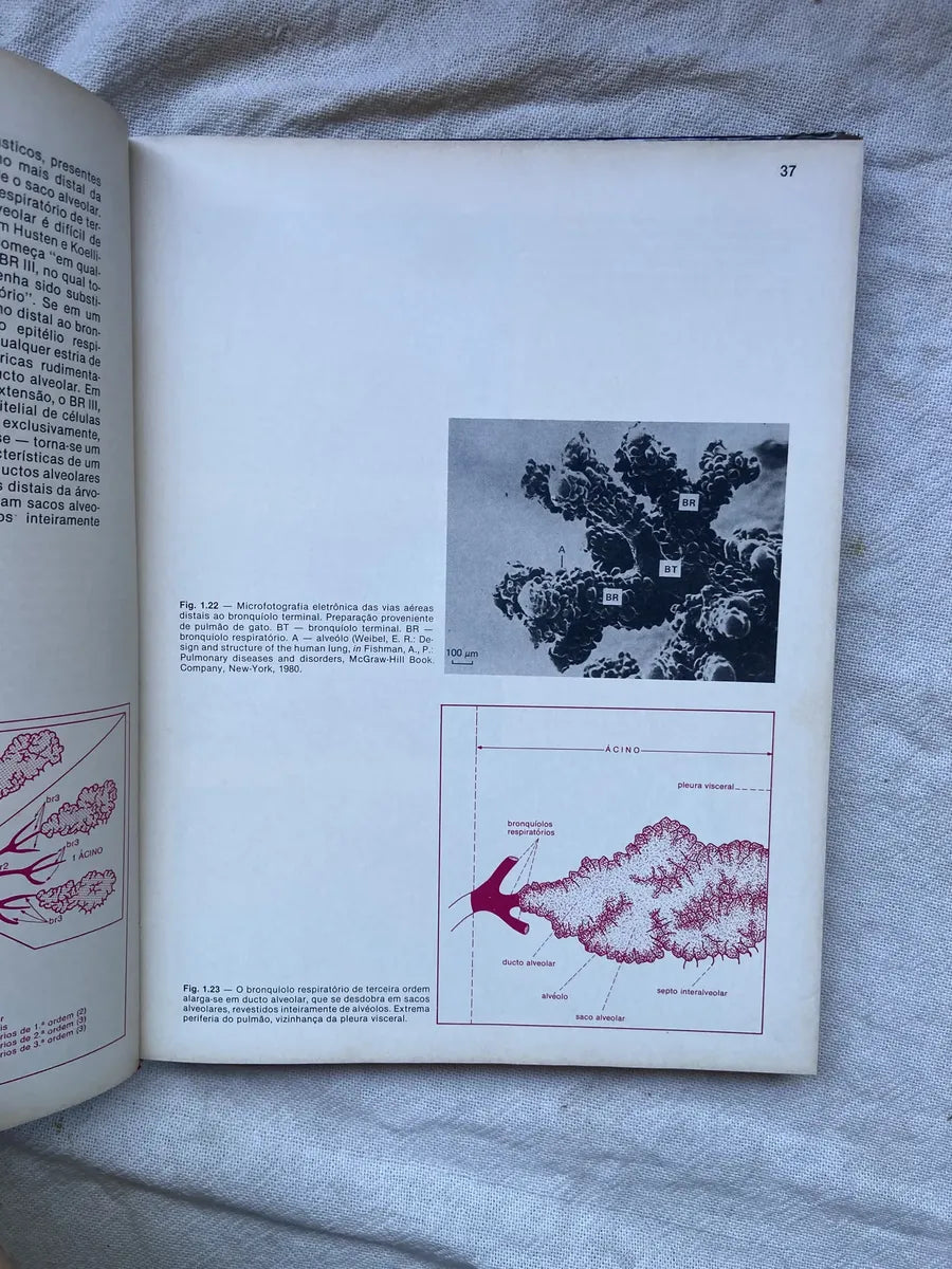 Livro Radiologia Pulmonar 1984 Capa Dura (Usado)