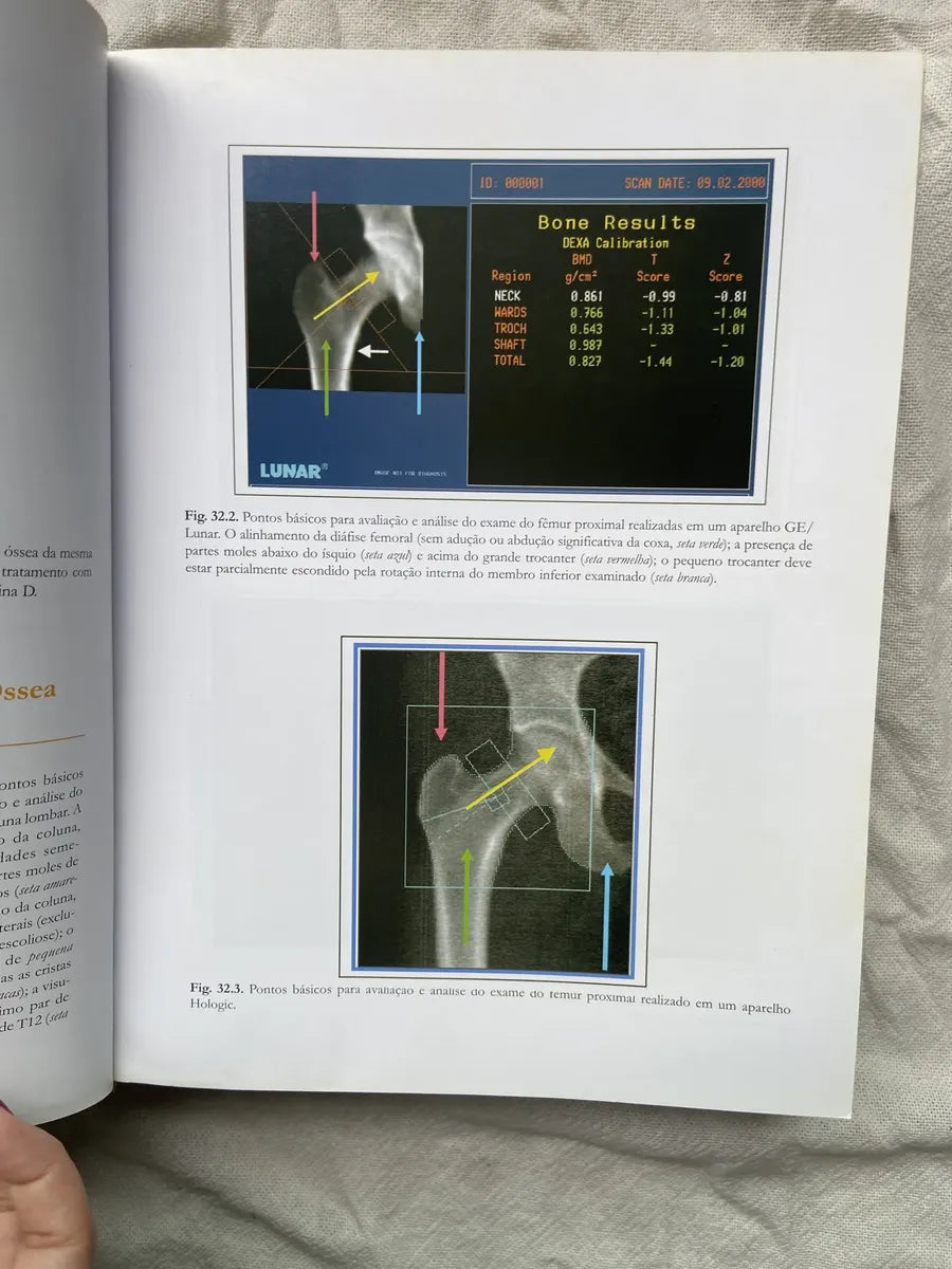 Livro Endocrinologia E Diabetes 2003 (Usado)